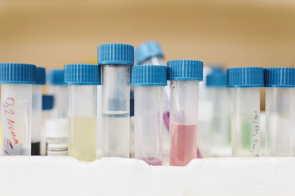 Test tubes in a laboratory rack